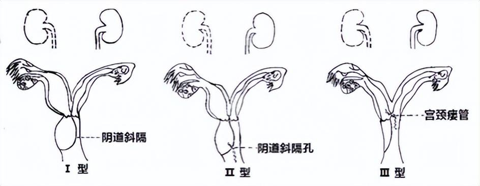 冬天寒冷痛入骨，老马识途有经验打一最佳生肖，详细解答、时代解答解释落实