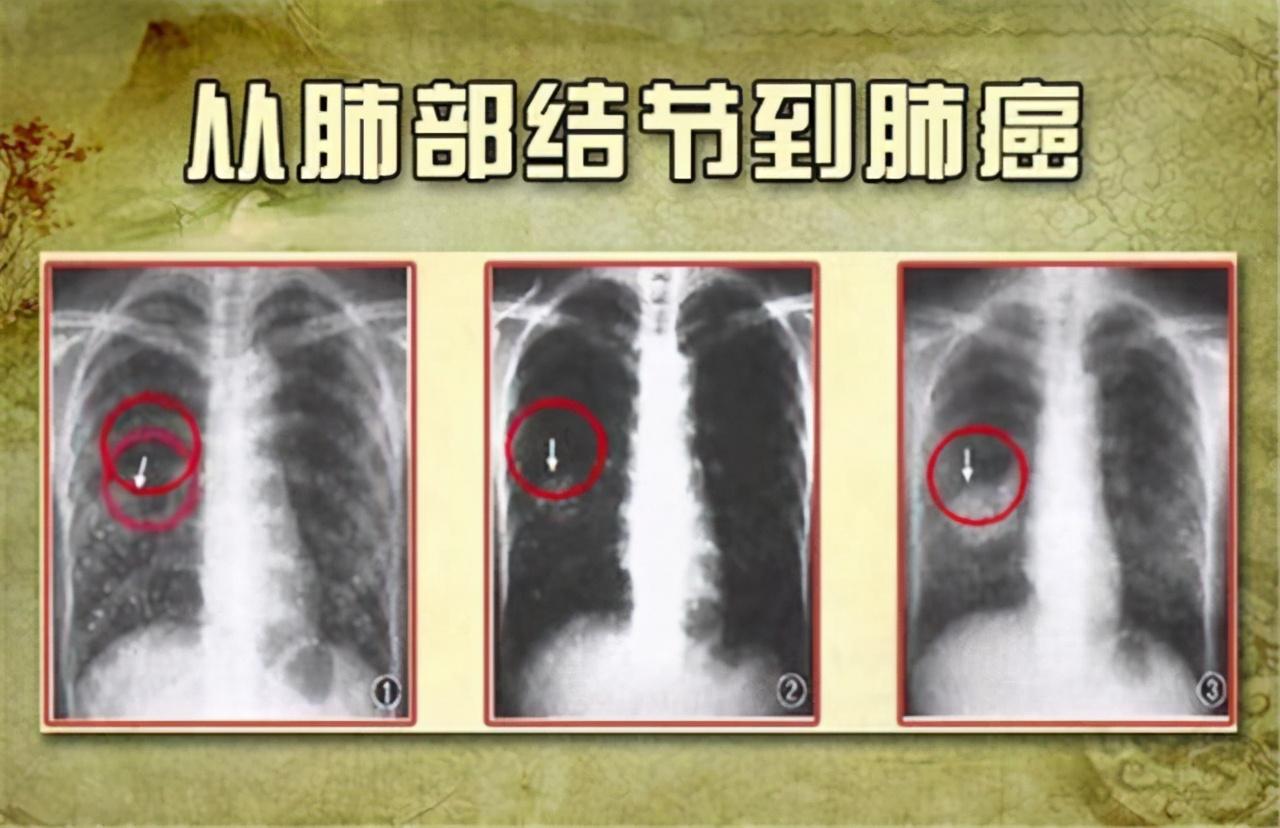 蛇龙摆尾打一最佳生肖，详细解答、精准解答解释落实
